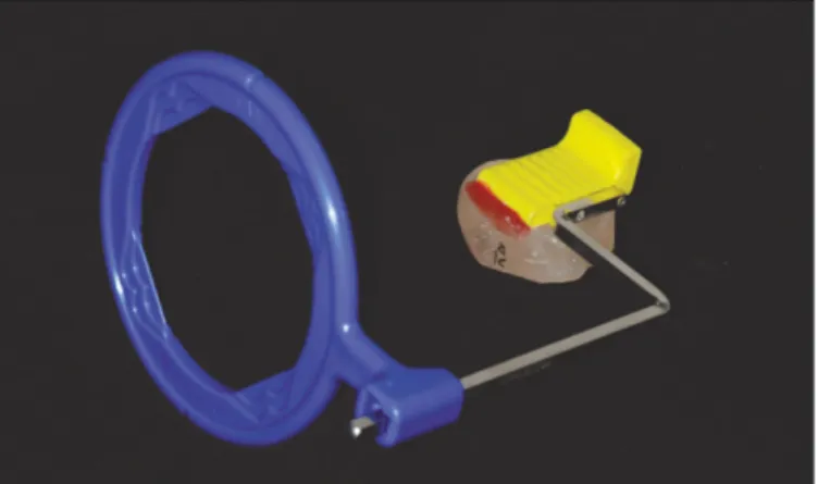 Fig. 1. Manufacture of customized resin bite.