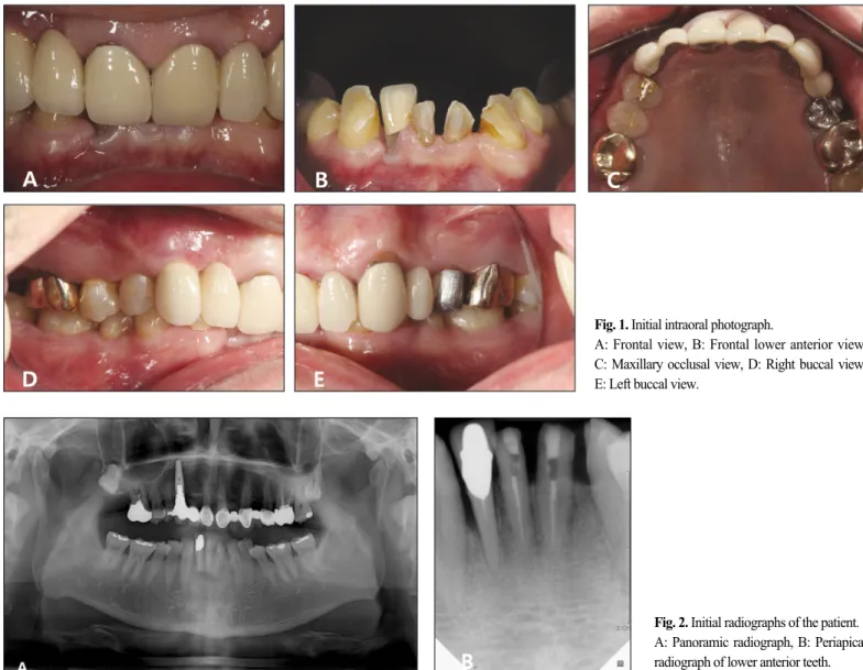 Fig. 1. Initial intraoral photograph.