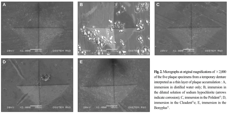 Fig. 2. Micrographs at original magnifications of ×2,000 of the five plaque specimens from a temporary denture interpreted as a thin layer of plaque accumulation : A, immersion in distilled water only; B, immersion in the diluted solution of sodium hypochl
