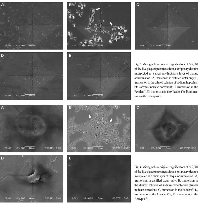 Fig. 3. Micrographs at original magnifications of ×2,000 of the five plaque specimens from a temporary denture interpreted as a medium-thickness layer of plaque accumulation : A, immersion in distilled water only; B, immersion in the diluted solution of so