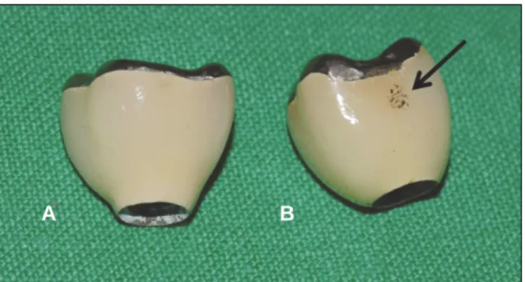 Fig. 1. Generated large bubble. Fig. 2. Effect of immersion in acetone. A: Removal of organic materials, B: Combustion of organic materials.