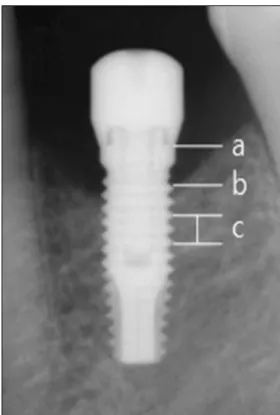 Fig. 2. References used to measure actual marginal bone loss.