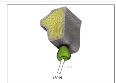 Fig. 4. Loading condition applied 150 N at 11 degree angle relative to the lingual cusp.