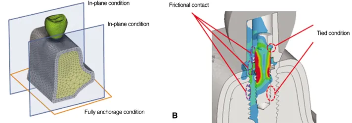 Fig. 6. Comparison between S (segmentally randomized osseointegration) and W (wholly randomized osseointegration) group according to osseointegraton degrees (40, 70%)