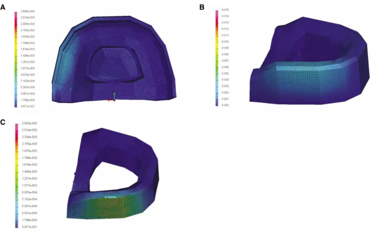 Fig. 2. Contour plots of von Mises stress distribution in obturator model model (GPa)