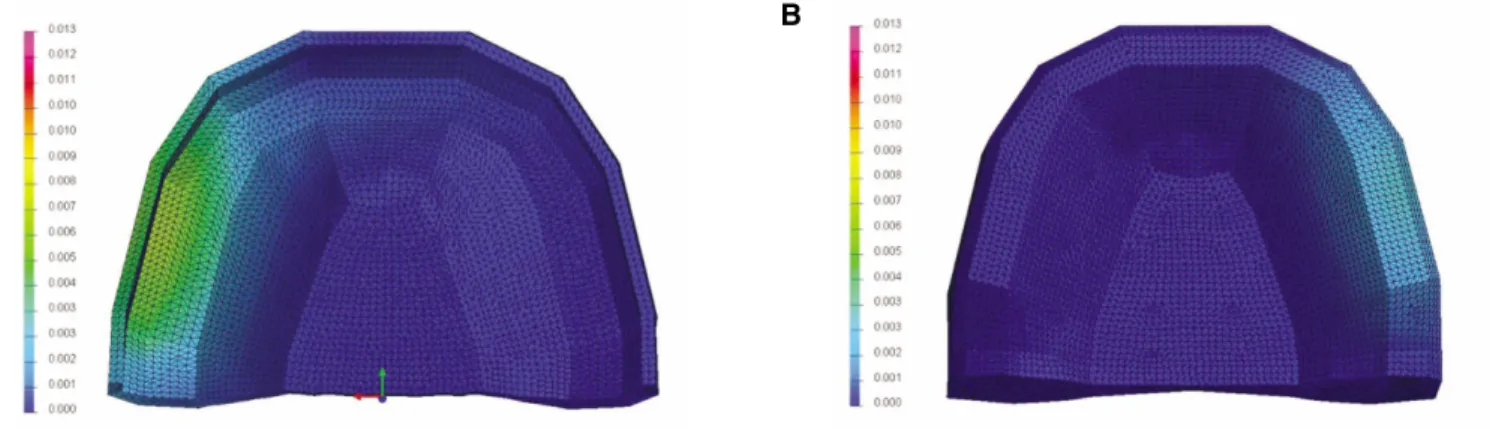 Fig. 5. Contour plots of displacement in complete denture (mm). A: tissue surface of obturator, and B: cortical bone.