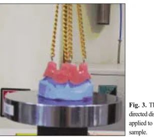 Fig. 3. The vertically directed dislodging force applied to the resin base sample.