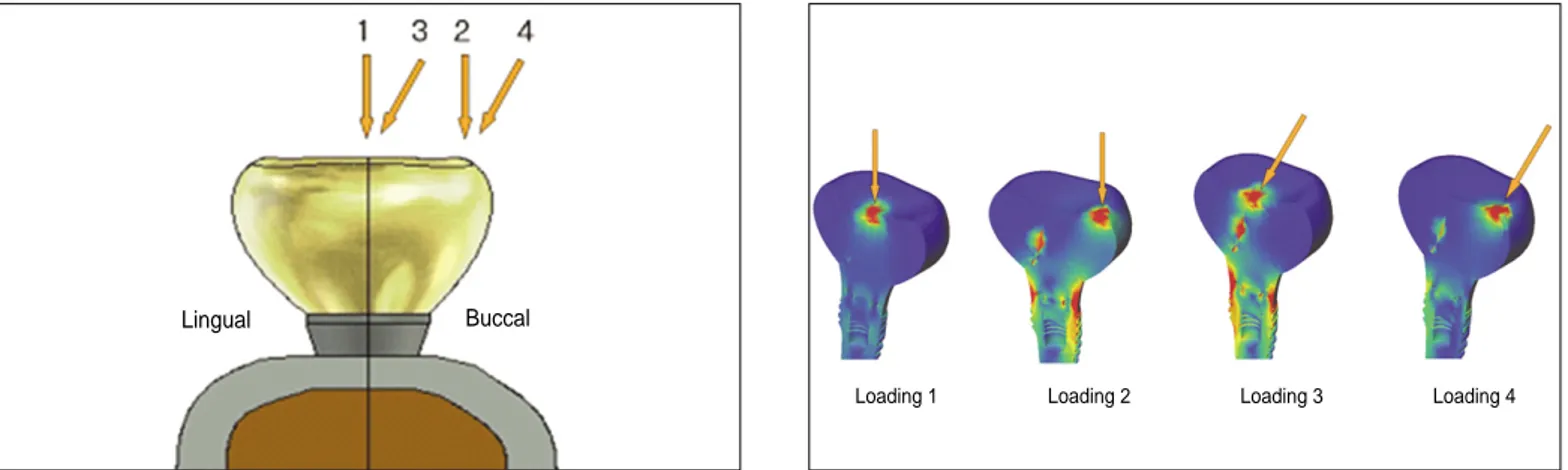 Fig. 2. Locations and directions of loadings. Fig. 3. Stress concentration in superstructure (Model 1).