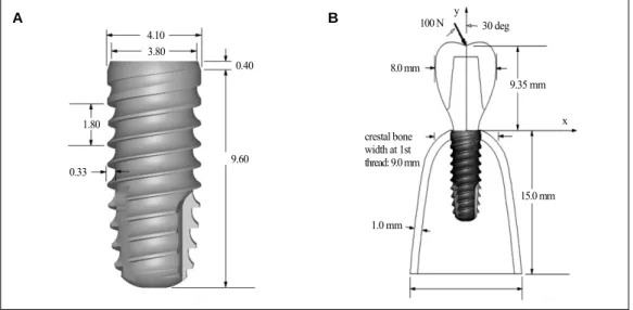 Fig. 1. Schematic presentation of the implant/bone complex shown in a bucco-lingual aspect showing.