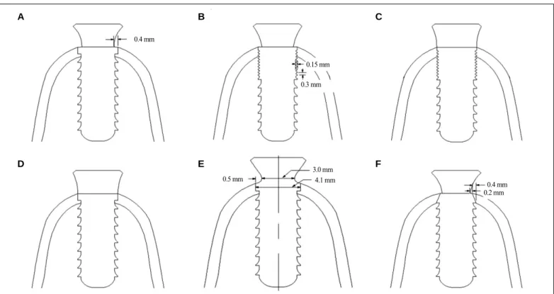 Fig. 3. Typical finite element mesh (control model).