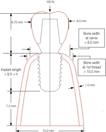Fig. 1. Submerged type implant fixture with reverse slope at the crestal module.