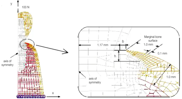 Fig. 3. Typical finite element mesh - detailed mesh profile on the marginal bone shown in the box.