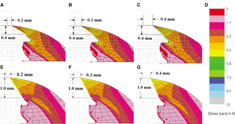 Fig. 5. Stress distribution on the external surface of marginal bone around the six test implant models