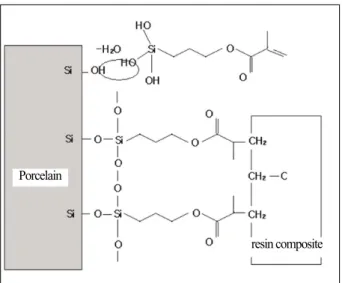 Fig. 1. Schematic representation of a strong chemical bond between the dental porcelain and resin composite can be achieved by treatment with a silane coupling agent.