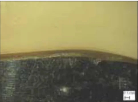 Fig. 4. Measurement of the marginal discrepancy using the video micro- micro-scope system just after sintering (× 100).
