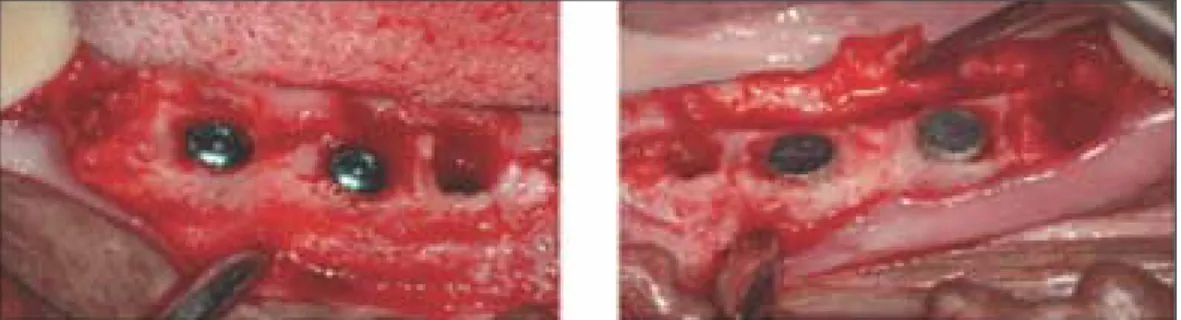 Fig. 1. Photograph illustrating the position of the implants placed. 