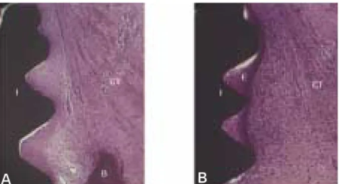 Fig. 6. Micrographs showing longitudinal lingual section of magnet group (A) and control group (B) after 12 weeks of healing in the cervical region of the implants
