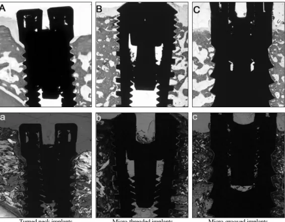 Fig. 3. Bone attachment (B) over 12 ㎛ micro- micro-grooved area and fibroblasts (F) attachments over 8