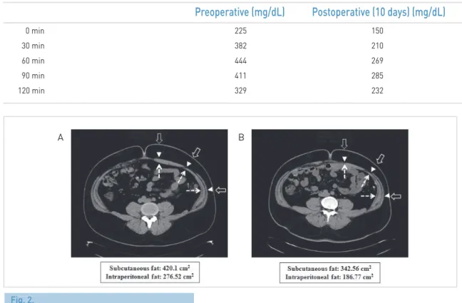 Table 3 .C  Perioperative changes of plasma glucose during the oral glucose tolerance test
