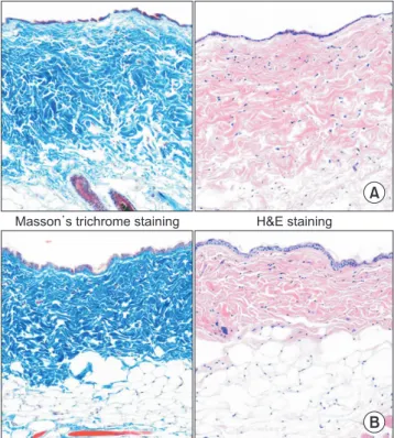 Figure 3. Histologic analysis of the scar tissue for control group (A) and  diurnal temperature group (B)