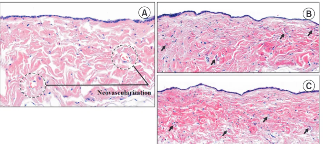 Table 1. Changes in Neovascular Formation and Scar Tissue Thickness in Diurnal Temperature Group and Control Group