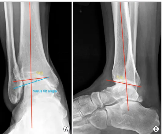 Figure 1. (A) Tibial anterior surface angle  (TAS) is the angle between tibial axis and  distal tibial articular surface on the  weight-bearing anteroposterior image