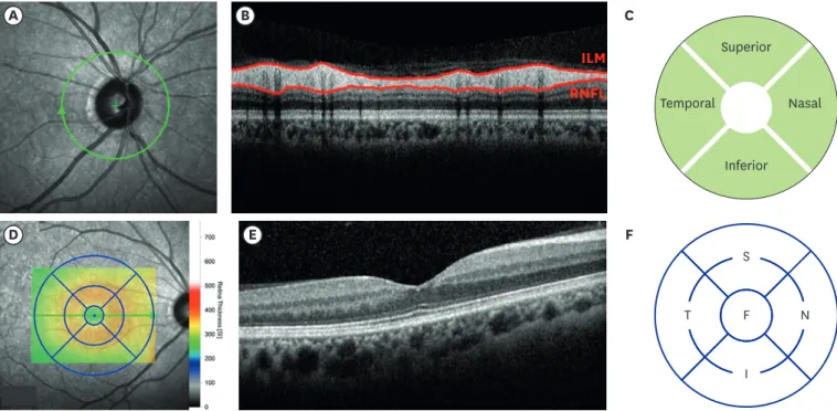 Fig. 1. OCT scans of right eye of patient showing normal RNFL and mRT values in all regions