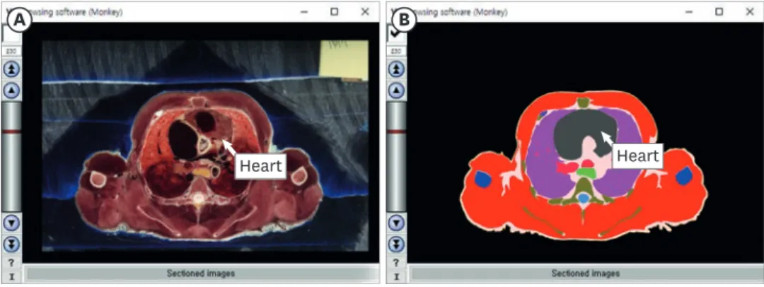 Fig. 1. Browsing software for a rhesus monkey. In the software, (A) the sectioned images and (B) segmented  images of the thorax are able to be browsed serially