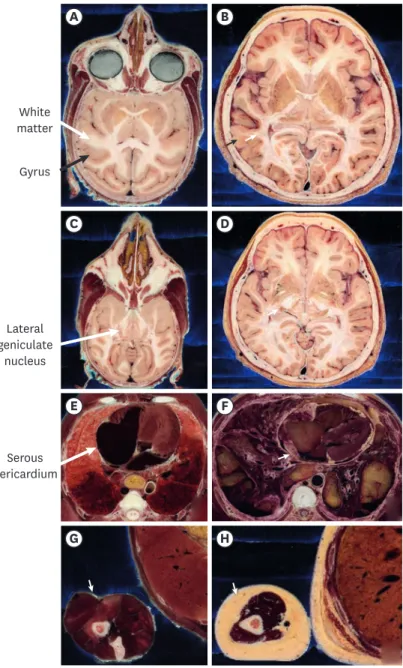 Fig. 5. Comparison of structures between a monkey and a human. In the head, (A) cerebral gyri of the monkey  are simpler than (B) those of the human (black arrow)