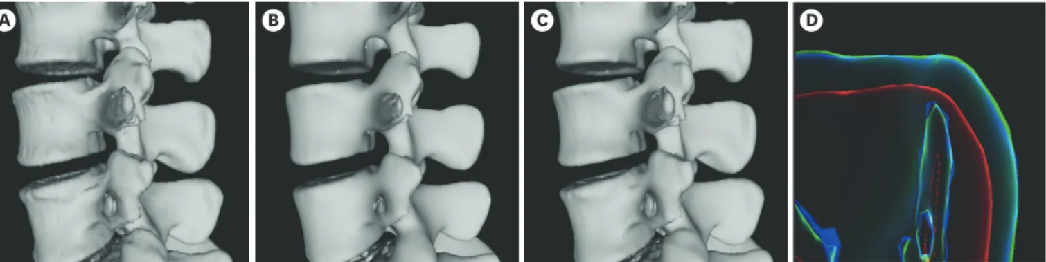 Fig. 11. Visual comparison of LOD model and models of application of Laplacian and Taubin smoothing