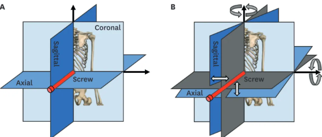 Fig. 1. The constructions of the MPR and its trajectory. (A) MPR sections, (B) trajectory of the MPR sections