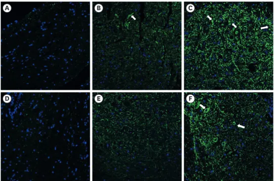 Fig. 3. The effect of subcutaneous PDRN on GFAP expression (luminous green) in DRG and spinal cord of SNL  model
