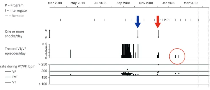 Fig. 1. Report of VT and VF episodes recorded by the patient's ICD. 