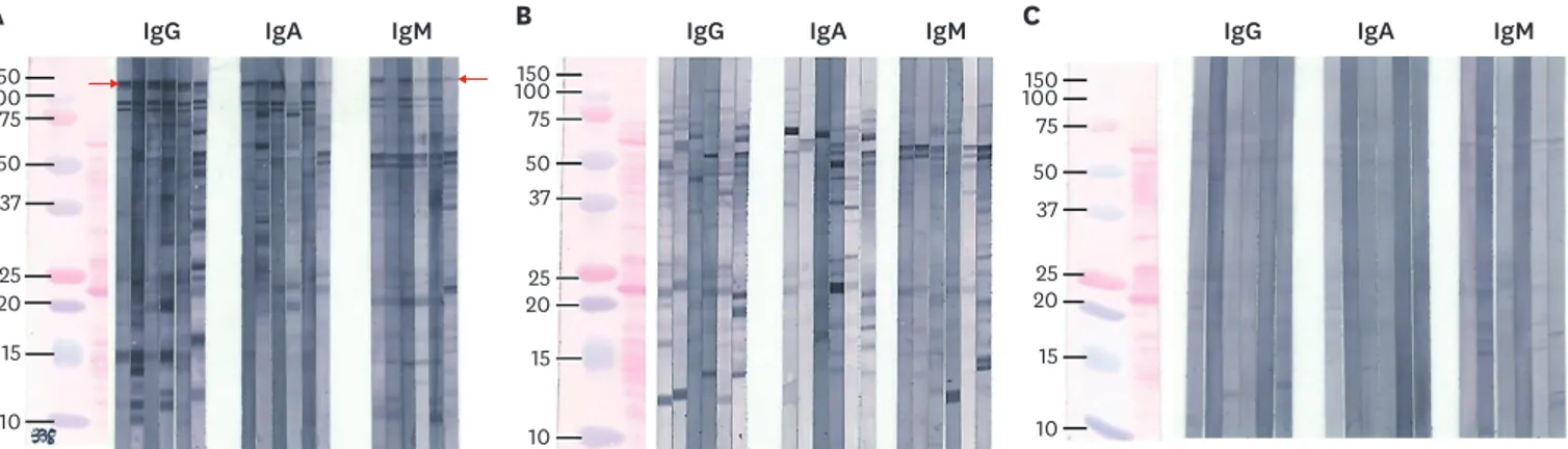 Fig. 1. Three different western blot patterns (A, B, and C) were identified. Only (A) showed reactivity with a 116–120 kDa band (red arrow).Thus it was considered  positive for IgG, IgA, and IgM anti-CagA-H