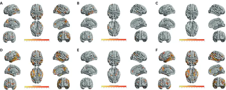 Fig. 2. Cortical thinning pattern correlated with the cognitive domain scores of Inbrain CST