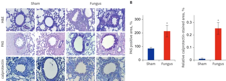 Fig. 2. H&amp;E staining, PAS and IHC staining of mouse lung paraffin sections. (A) Top panel: H&amp;E-stained lung tissue contained more inflammatory cell infiltrations  in Aspergillus sensitization/challenge mice than control mice