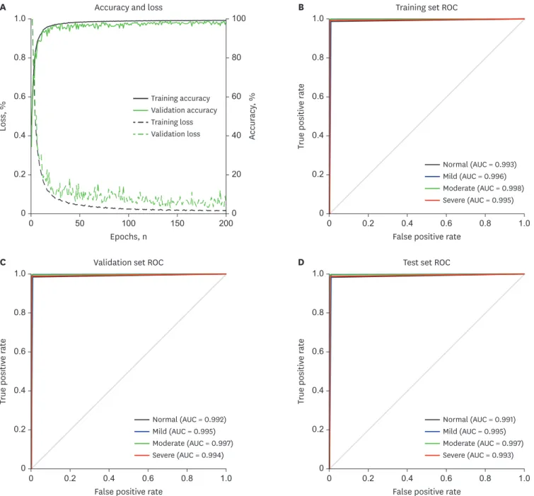 Fig. 3. Accuracy and ROC curve of the proposed method for SA severity identification based on deep learning using a short-term normal ECG signal