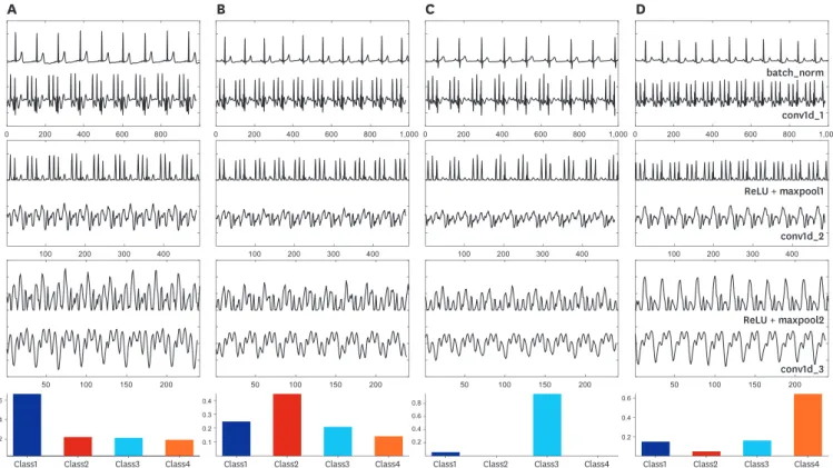 Fig. 4. Example of the output of the designed CNN model for the automatic prediction of SA using normal sinus rhythm