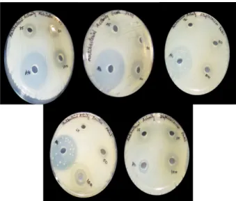 Figure 8. Antibacterial activity of 2 against Klebsiellla pneumo- pneumo-niae,  E. coli,  Streptococcus mutans, Bacillus subtilis,   Staphylo-coccus aureus.