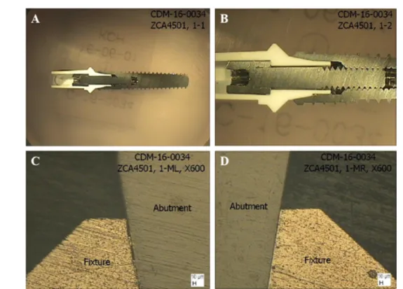 Fig. 8. Adaptation accuracy (A-Top view, B-Enlarge view, C &amp; D-Margin Opening)