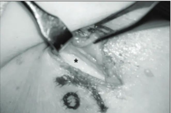 FIGURE 3. The skin is retracted to distal side with a retractor. 