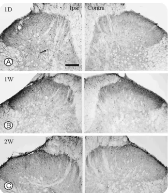 Fig. 4. Conforcal microscopy of spinal cord double labe- labe-led  for  pERK (green)  and  NK1 (red)  after  neurotomy