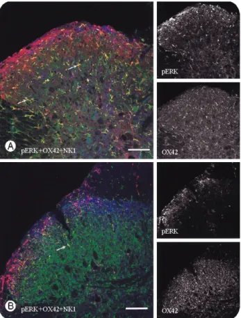 Fig.  7.  Confocal  microscopy  of  the  spinal  cords  triple  labeled  for  pERK(red),  OX-42(green),  and  NK1(blue)  in  ipsilateral dorsal horn at 1 day (A) and 2 weeks after  neu-rotomy