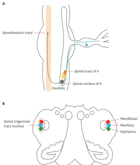 FIGURE 3. Spinal trigeminal tract descending as far as Caudal medulla and ascending through spinothalamic  tract (A, sagittal view) Three branch of central trigeminal bundle connecting with trigeminal nucleus in pons (B,  axial view).