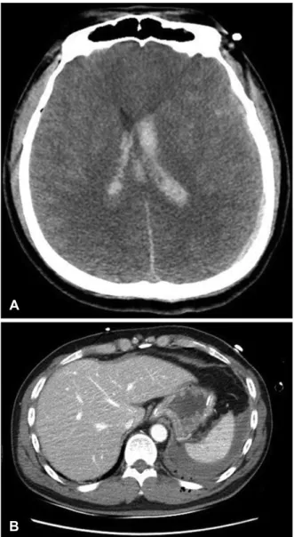 FIGURE 1. (A) Brain computed tomography (CT) and (B) ab- ab-dominal CT at emergency department