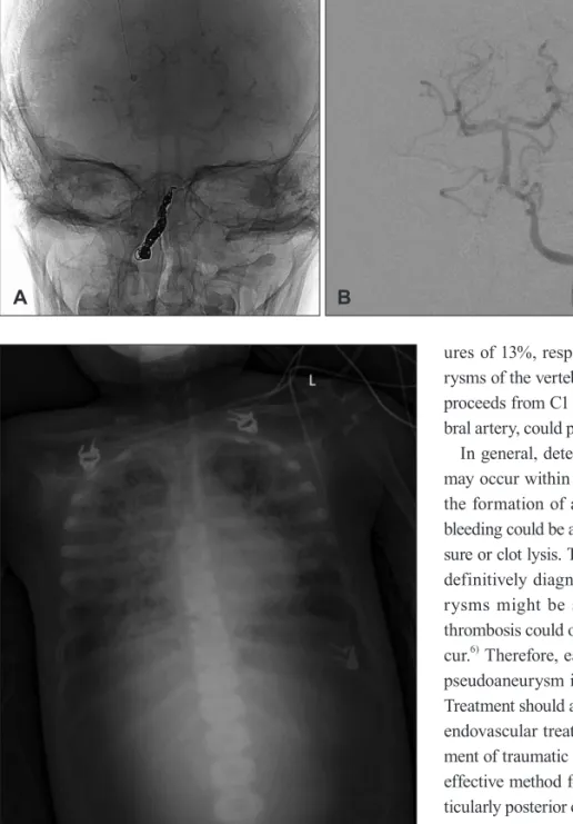 FIGURE 5. Chest X-ray showing haziness of both lung fields.