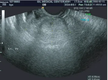 Fig. 2. Microscopic photography of steroid cell tumor, not otherwise specified. (A) The tumor consists of irregular cords and nests of large  rounded to polygonal cells (H&amp;E, x100)