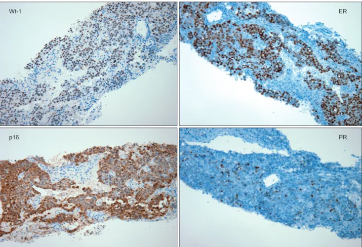 Fig. 2. Immunohistochemistry results of supraclavicular lymph node (×200).