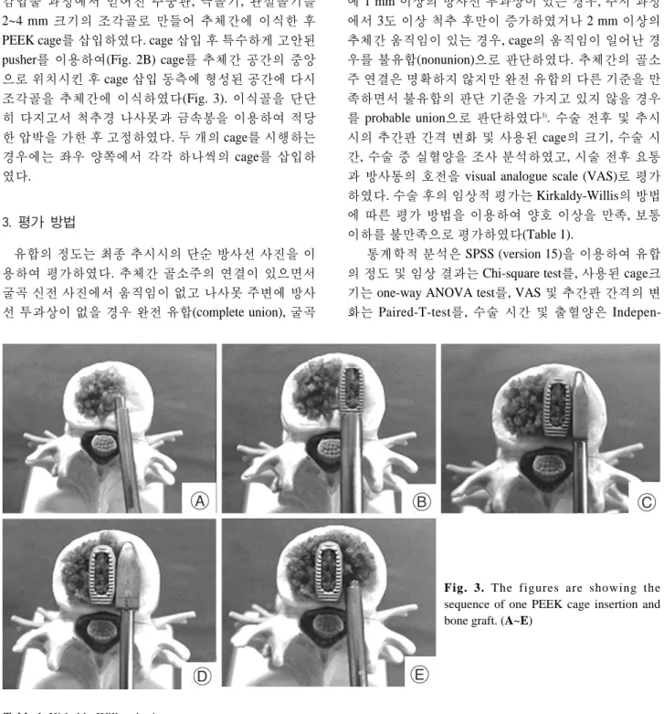 Fig. 3. The figures are showing the sequence of one PEEK cage insertion and bone graft