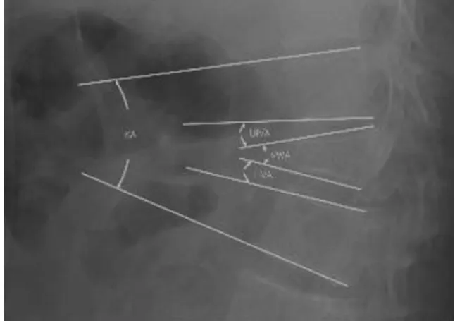 Fig. 1. Schematic diagram of geometric parameters mea- mea-sured on a lateral radiograph